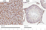 CD29 Antibody in Immunohistochemistry (Paraffin) (IHC (P))