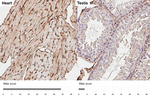 CD29 Antibody in Immunohistochemistry (Paraffin) (IHC (P))