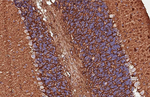 CD29 Antibody in Immunohistochemistry (Paraffin) (IHC (P))
