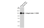 CD29 Antibody in Western Blot (WB)
