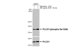Phospho-PLCG1 (Ser1248) Antibody in Western Blot (WB)