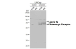 alpha-2a Adrenergic Receptor Recombinant Rabbit Monoclonal Antibody (HL3723)