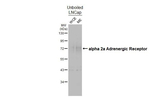 alpha-2a Adrenergic Receptor Antibody in Western Blot (WB)