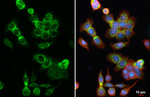 HKDC1 Recombinant Rabbit Monoclonal Antibody (HL3743)
