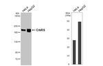 CDK12 Recombinant Rabbit Monoclonal Antibody (HL3756)