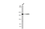 CDK12 Antibody in Western Blot (WB)