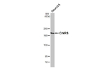 CDK12 Antibody in Western Blot (WB)