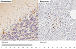 BASP1 Antibody in Immunohistochemistry (Paraffin) (IHC (P))