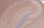 BASP1 Antibody in Immunohistochemistry (Paraffin) (IHC (P))