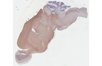 BASP1 Antibody in Immunohistochemistry (Paraffin) (IHC (P))