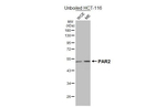 PAR2 Antibody in Western Blot (WB)