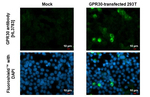 GPR30 Antibody in Immunocytochemistry (ICC/IF)