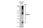 GPR30 Antibody in Western Blot (WB)