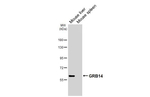 GRB14 Recombinant Rabbit Monoclonal Antibody (HL3786)