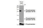 Phospho-Phospholamban (Ser16) Antibody in Western Blot (WB)
