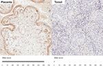 VEGF Receptor 1 Recombinant Rabbit Monoclonal Antibody (HL3799)