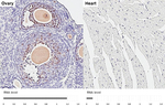 RAD51 Antibody in Immunohistochemistry (Paraffin) (IHC (P))