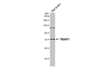 TRAP1 Antibody in Western Blot (WB)