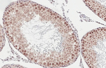 ALY Antibody in Immunohistochemistry (Paraffin) (IHC (P))