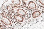 ALY Antibody in Immunohistochemistry (Paraffin) (IHC (P))