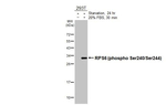 Phospho-S6 (Ser240, Ser244) Antibody in Western Blot (WB)