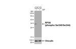Phospho-S6 (Ser240, Ser244) Antibody in Western Blot (WB)