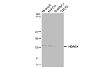 HDAC4 Recombinant Rabbit Monoclonal Antibody (HL3838)