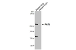 PATJ Antibody in Western Blot (WB)