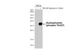 Phospho-NPM1 (Thr237) Antibody in Western Blot (WB)