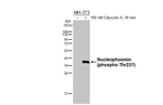 Phospho-NPM1 (Thr237) Recombinant Rabbit Monoclonal Antibody (HL3855)