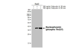 Phospho-NPM1 (Thr237) Antibody in Western Blot (WB)
