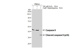 Caspase 9 Recombinant Rabbit Monoclonal Antibody (HL3857)