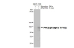 Phospho-PYK2 (Tyr402) Antibody in Western Blot (WB)