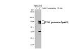 Phospho-PYK2 (Tyr402) Recombinant Rabbit Monoclonal Antibody (HL3860)