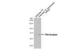 TSH Receptor Antibody in Western Blot (WB)