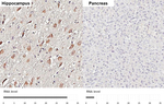 HTR1E Recombinant Rabbit Monoclonal Antibody (HL3875)