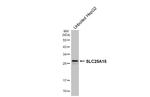 ORNT1 Antibody in Western Blot (WB)