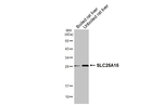 ORNT1 Antibody in Western Blot (WB)