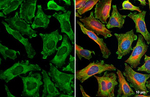 TRAF6 Recombinant Rabbit Monoclonal Antibody (HL3886)