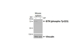 Phospho-BTK (Tyr223) Antibody in Western Blot (WB)