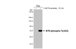 Phospho-BTK (Tyr223) Recombinant Rabbit Monoclonal Antibody (HL3887)