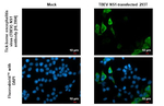 Tick-Borne Encephalitis Virus NS1 Recombinant Rabbit Monoclonal Antibody (HL3904)