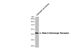 beta-2 Adrenergic Receptor Antibody in Western Blot (WB)