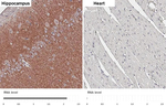 CHRM1 Antibody in Immunohistochemistry (Paraffin) (IHC (P))