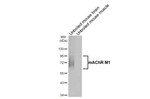 CHRM1 Antibody in Western Blot (WB)