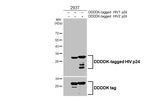 HIV1/2 p24 Antibody in Western Blot (WB)
