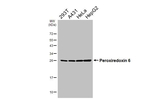 PRDX6 Recombinant Rabbit Monoclonal Antibody (HL3952)