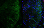 ADORA2B Recombinant Rabbit Monoclonal Antibody (HL3959)