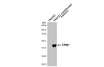 CPN1 Recombinant Rabbit Monoclonal Antibody (HL3979)