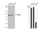STAT2 Recombinant Rabbit Monoclonal Antibody (HL3985)